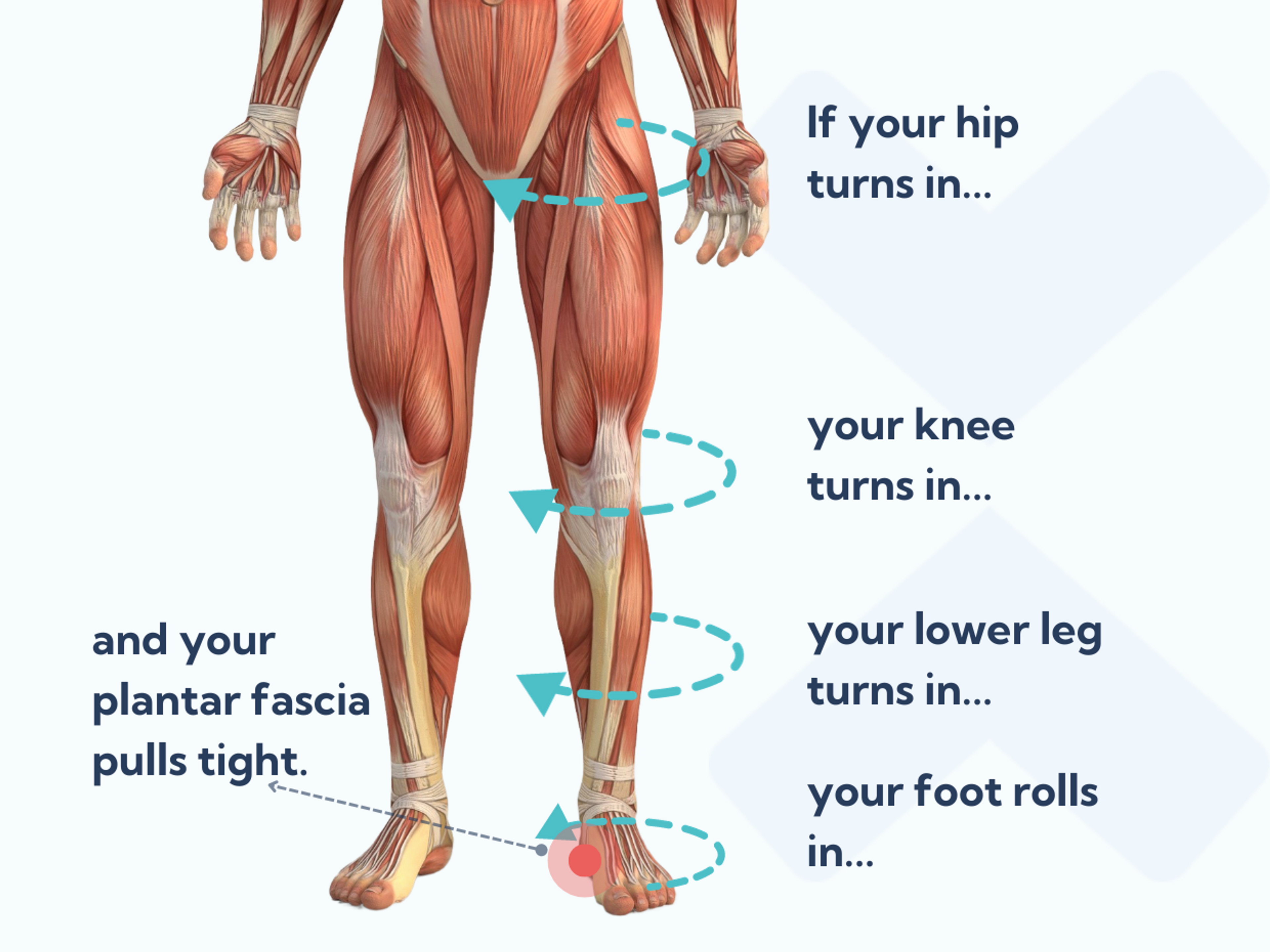 Poor movement patterns due to muscle weakness may cause your plantar fascia to become overloaded.