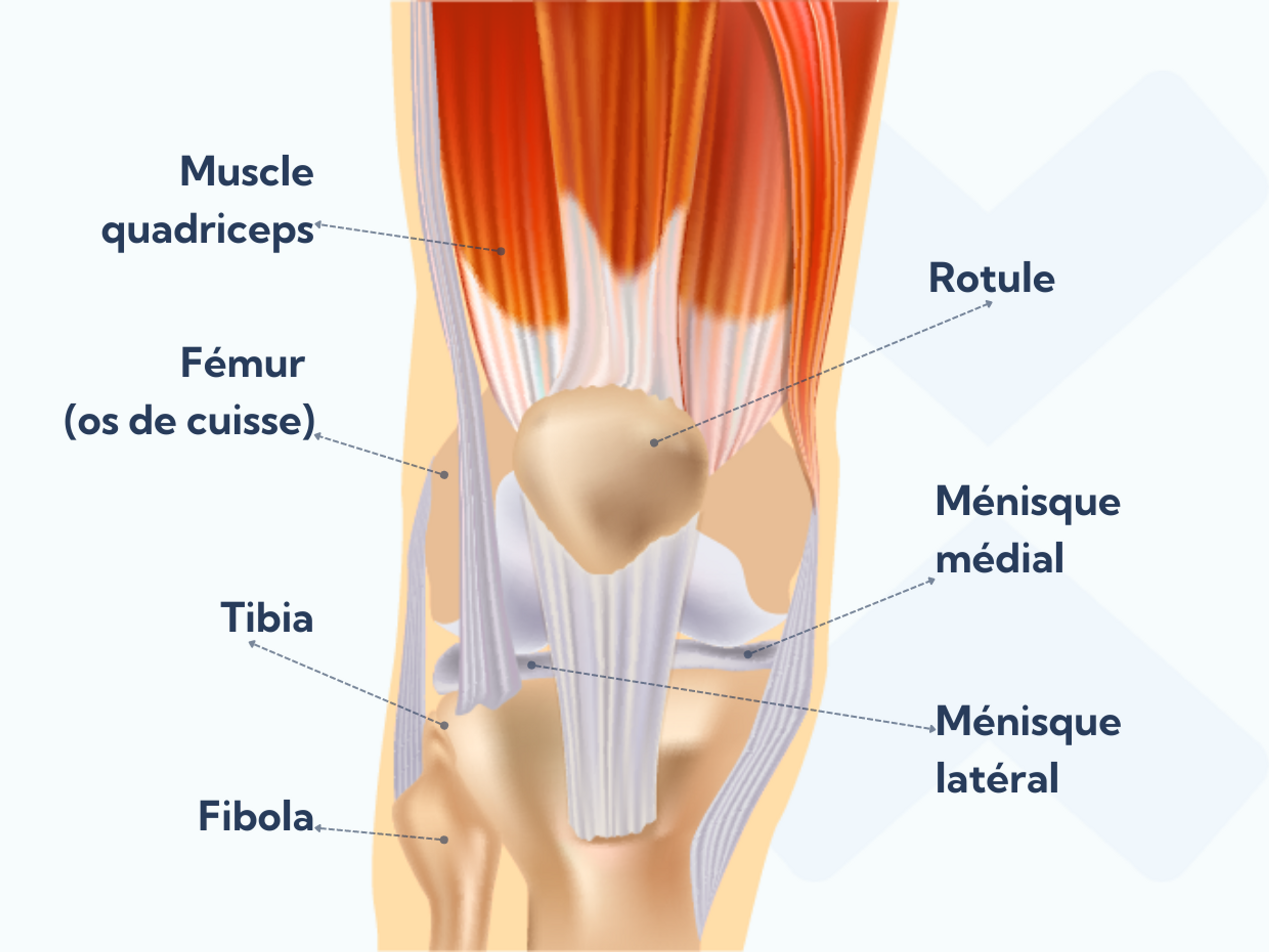 Le gonflement du genou après une entorse n’est possible que si vous blessez une structure située à l’intérieur de l’articulation du genou.