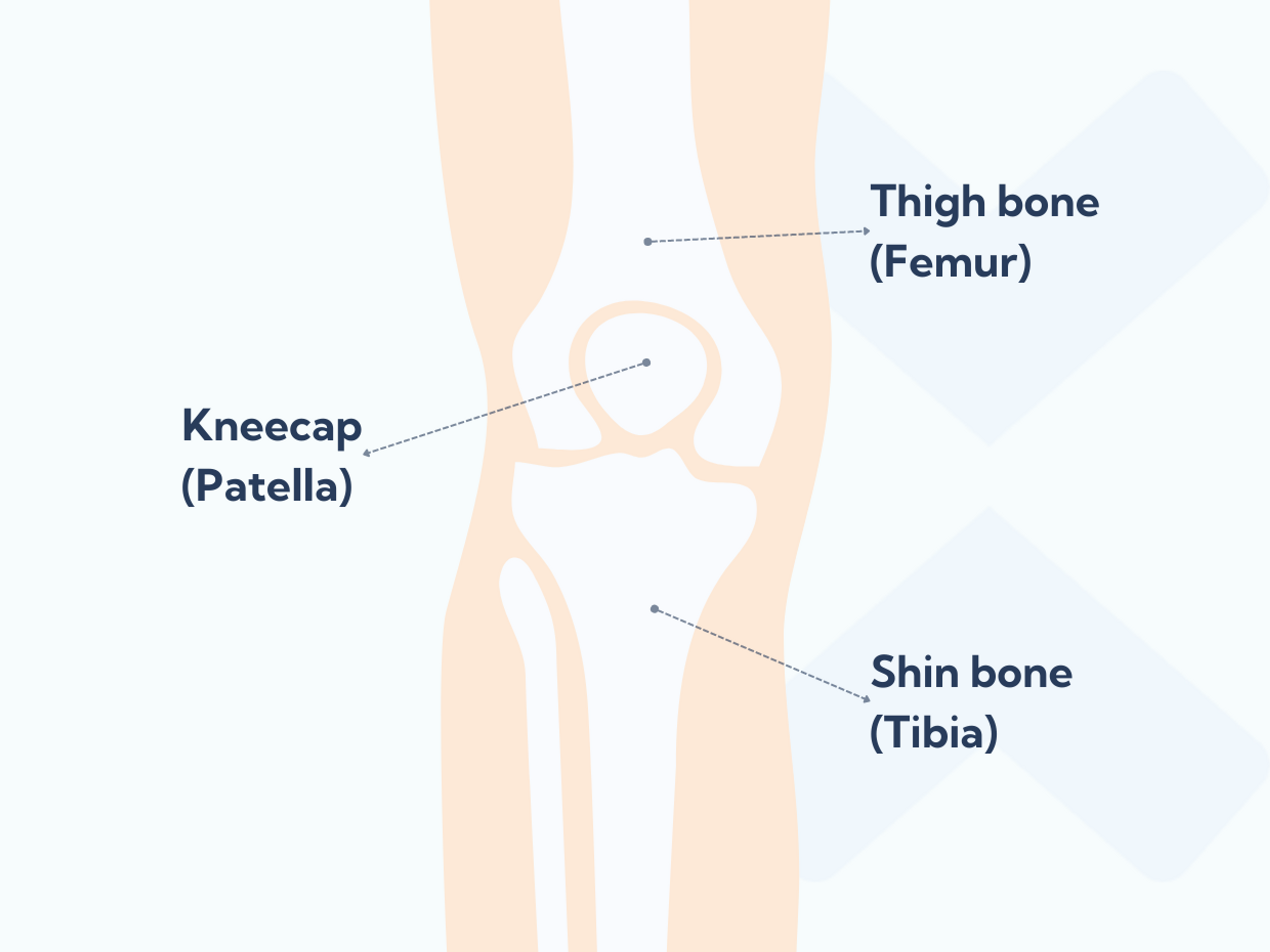 The anatomy of the patellofemoral joint showing the kneecap, shin bone and thigh bone.