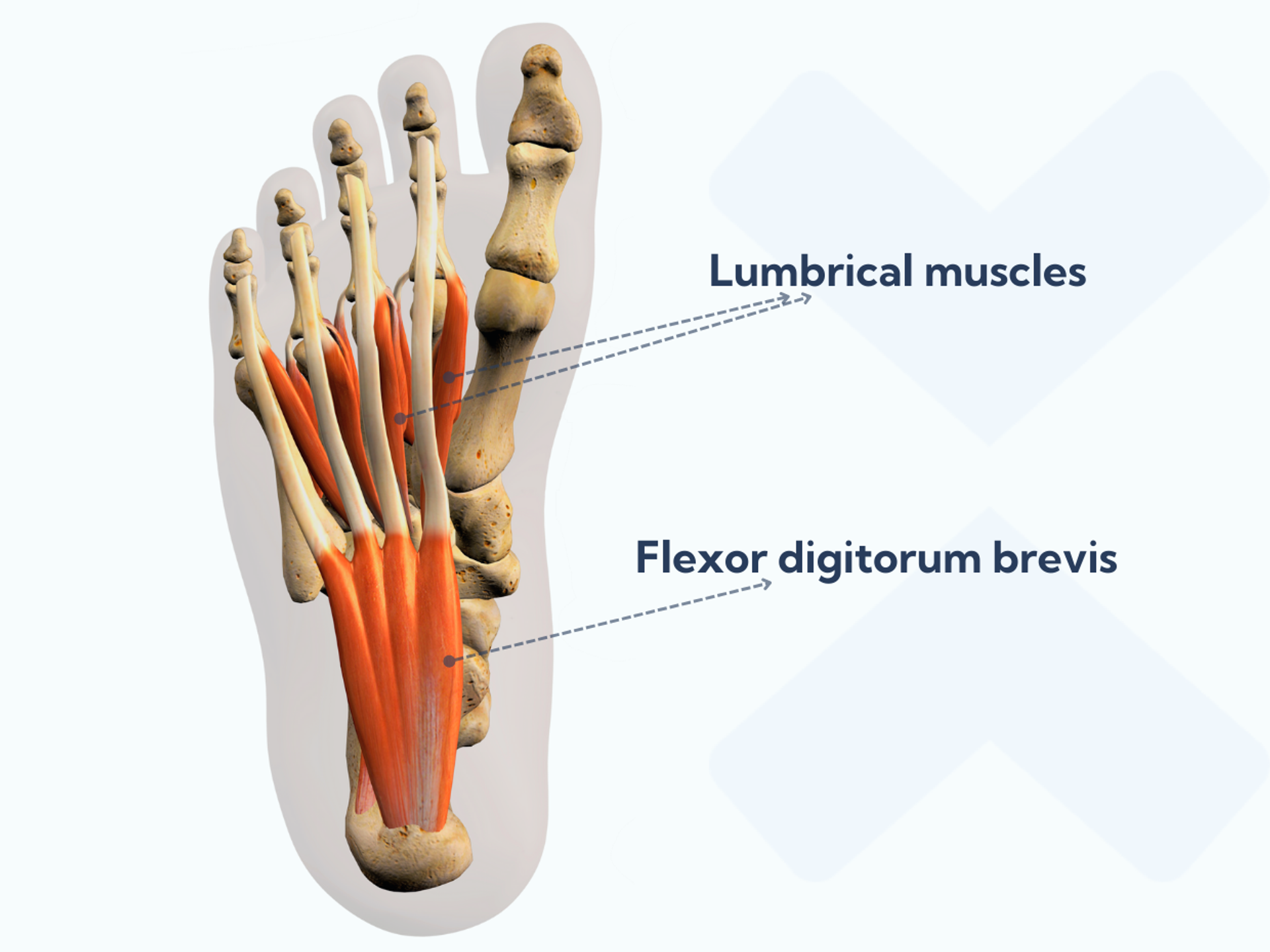 Foot exercises for plantar fasciitis - Optimizing strength and control