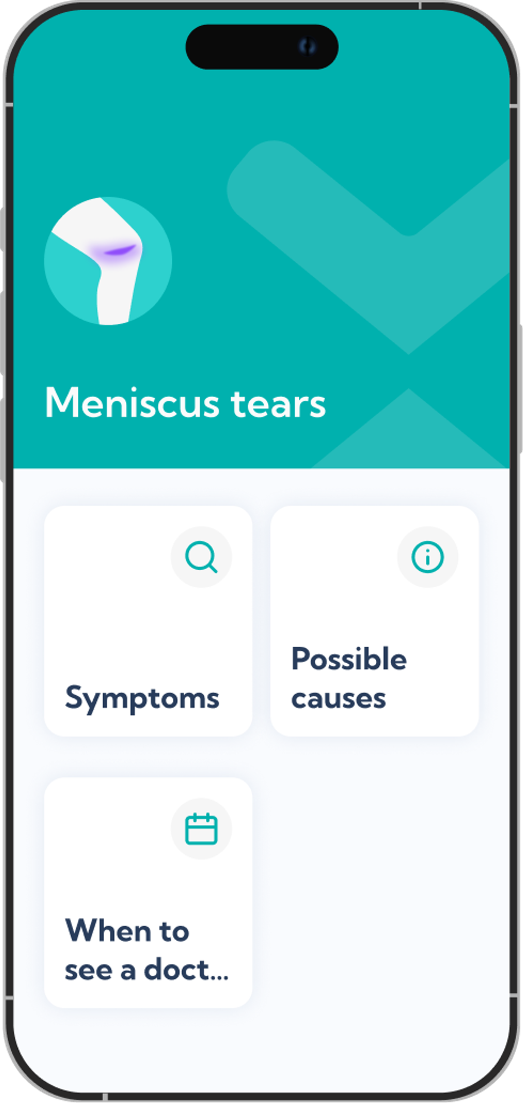 Meniscus tear treatment plan overview screen in the Exakt app.
