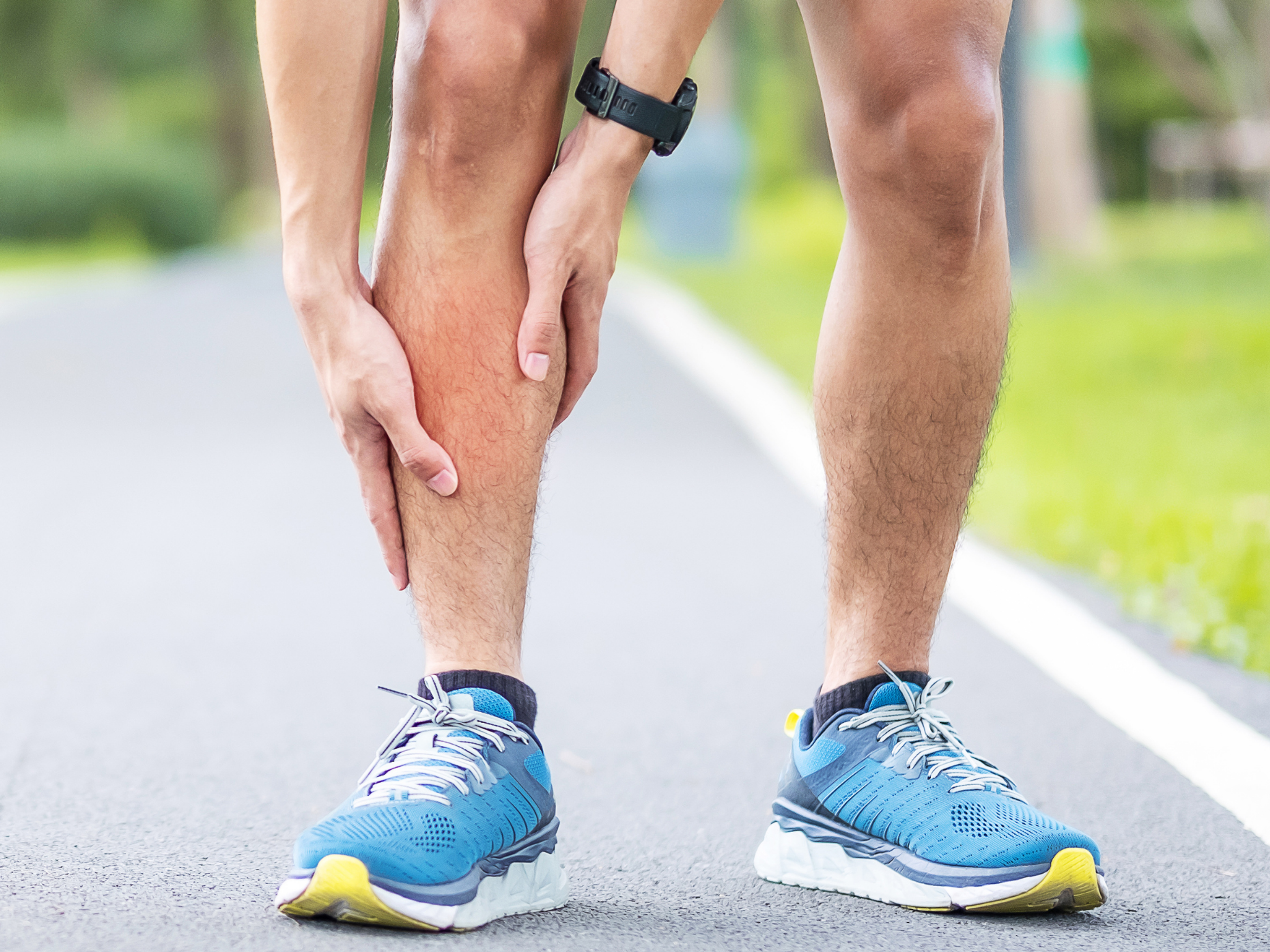 Shin splints is an example of a running overuse injury in the lower leg.