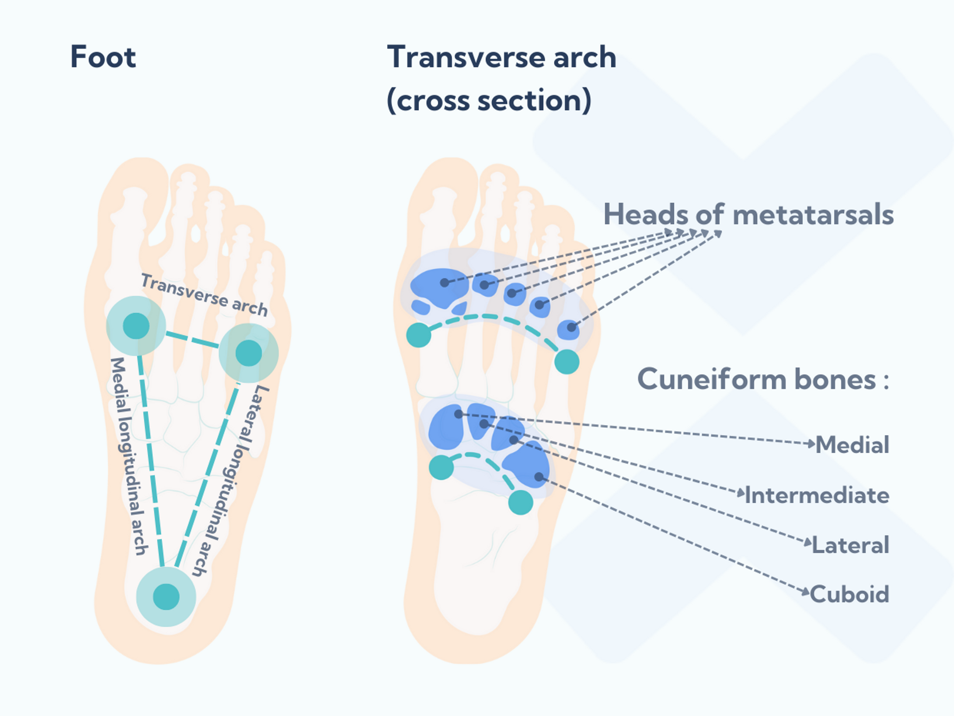 Arch Injuries Can insoles help with shin splints? (and how to choose the right ones)