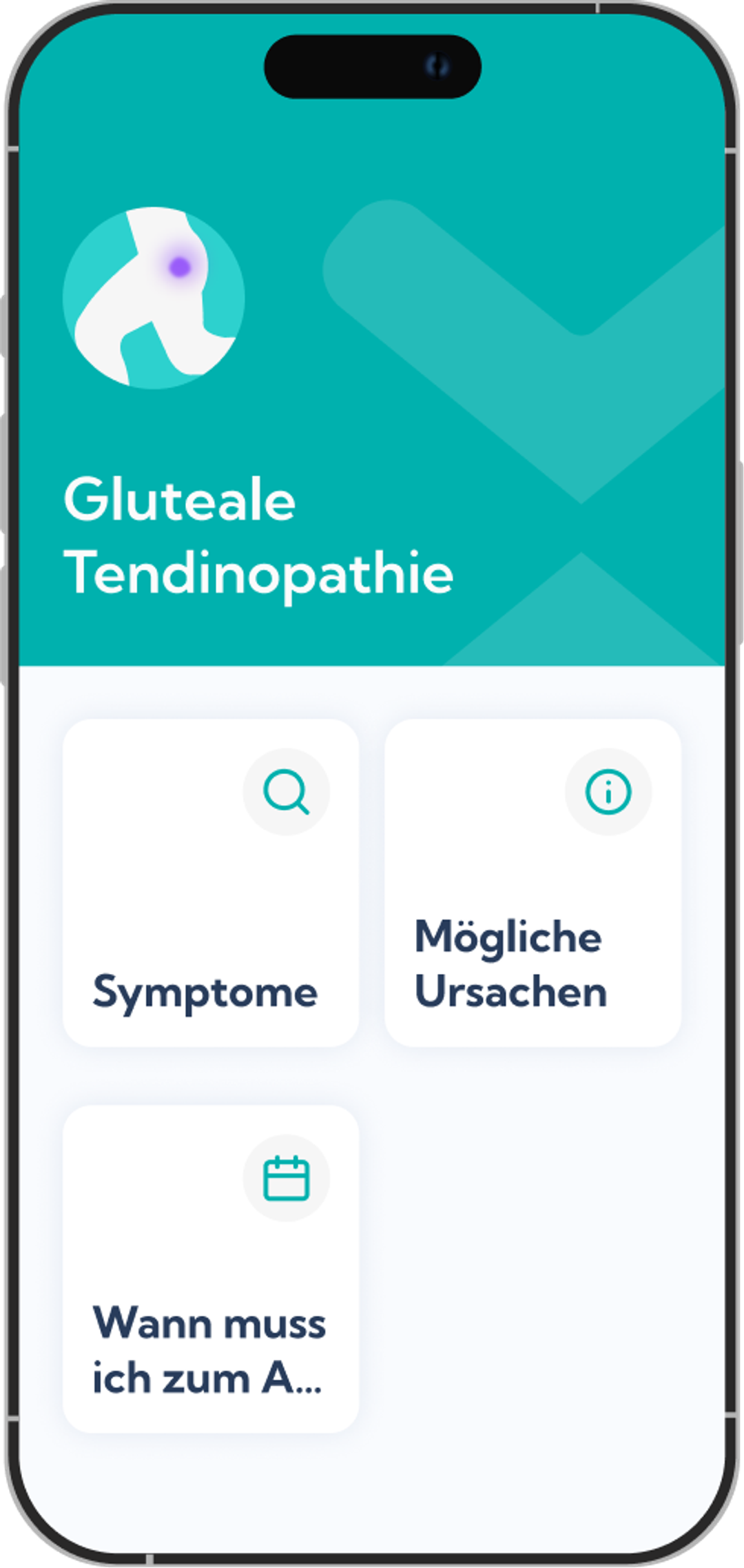 Gluteale Tendinopathie Reha-Plan Übersicht in der Exakt App 