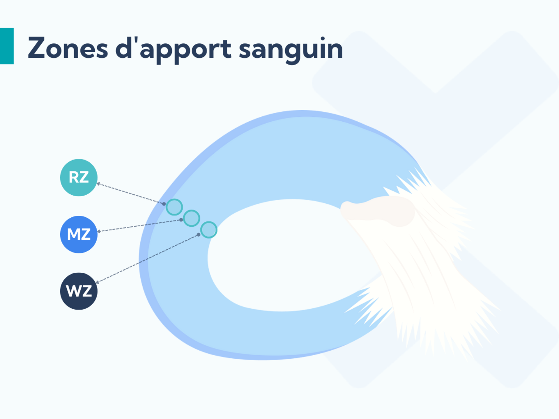 Fissure du ménisque symptômes, causes et traitement