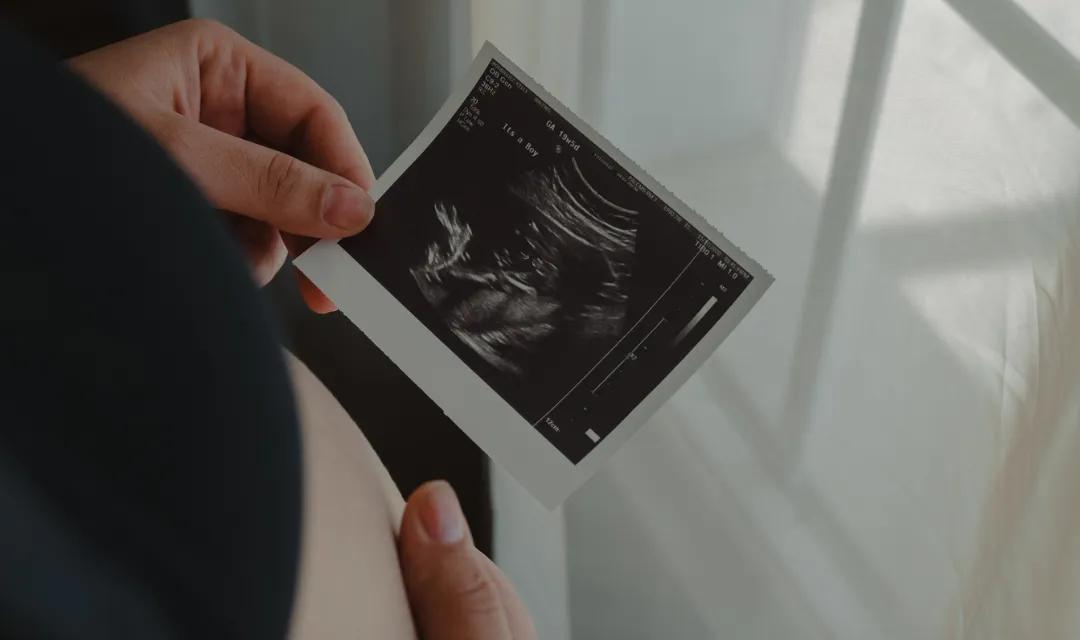 Week 30: Brain Growth Sprint - The Final Neural Development