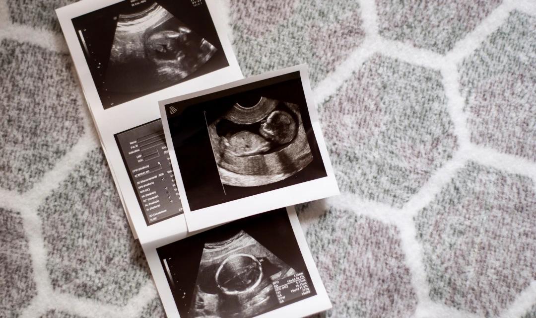 Your Baby's Facial Features Begin to Form