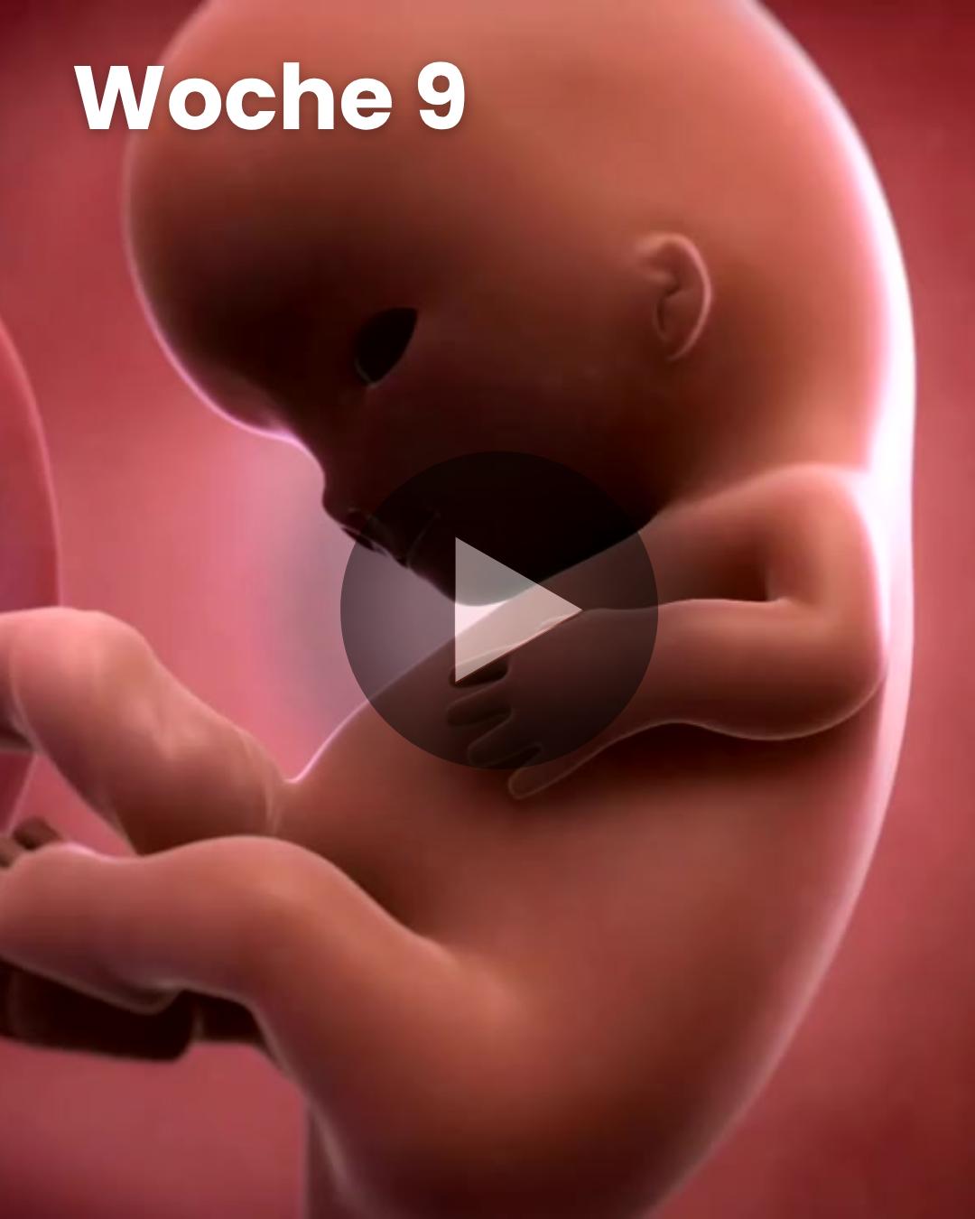 3D-Video des Kindes: Woche 9