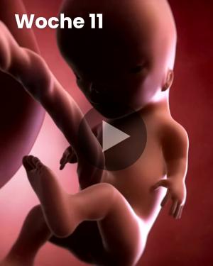 3D-Video des Kindes: Woche 11