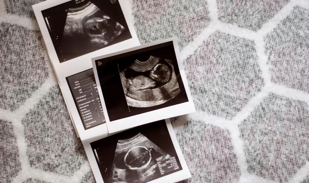Week 12: First Trimester Finale - Completing the Foundation