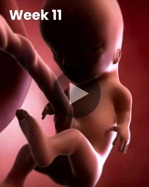 3D video baby update: Week 11