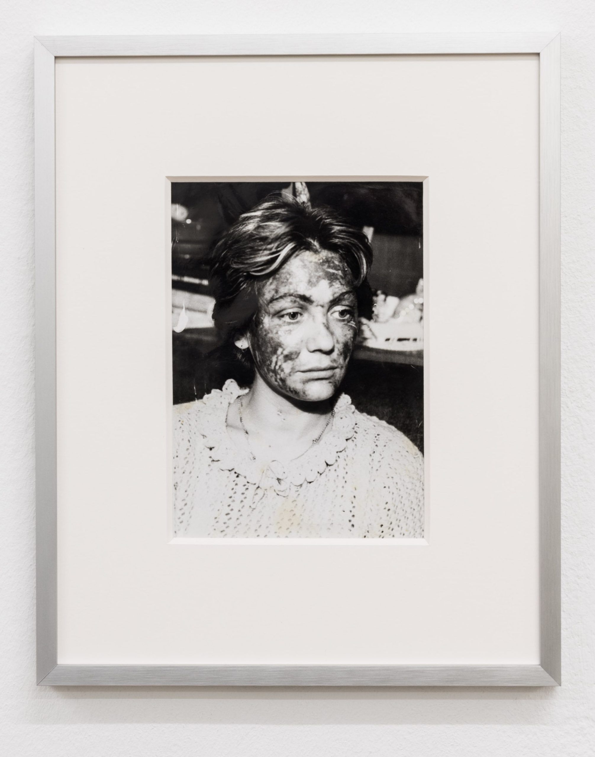 After The Accident I Became Less Visible (with Omer Arnaut) — Joschua Yesni Arnaut