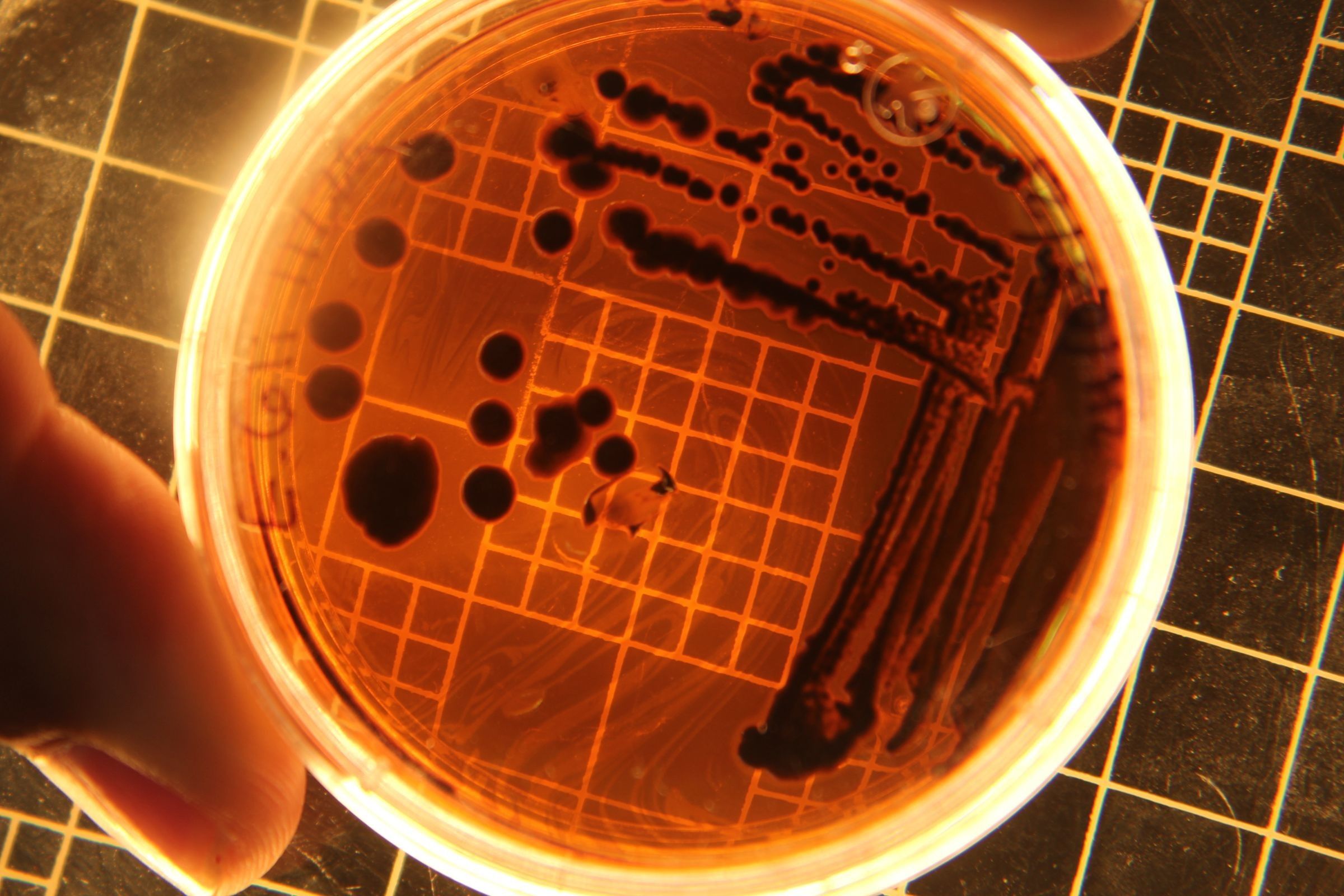 A hand holds a glowing petri dish with dark bacterial colonies and streaks on orange agar over a gridded mat.