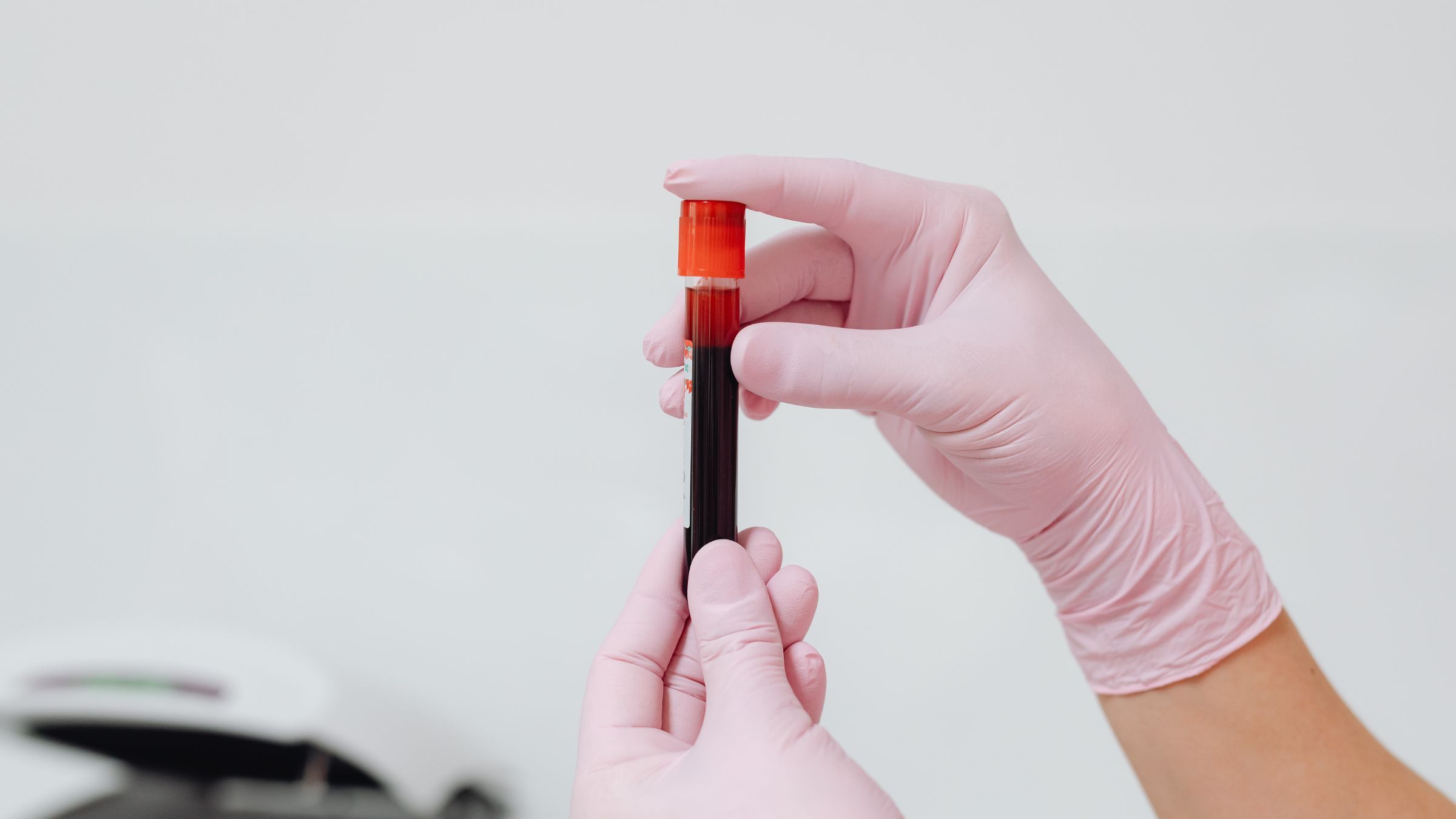 A gloved hand holding a vial of blood drawn for lab testing