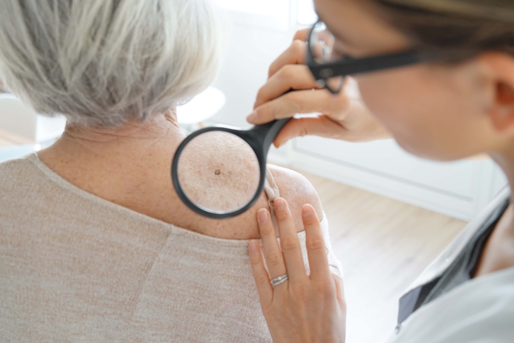 Image What Are Your Rights When Skin Cancer Goes Undiagnosed?
