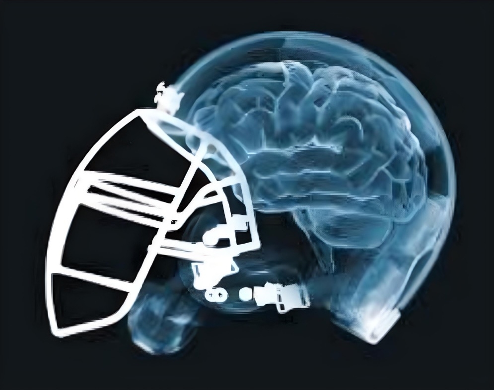 Image Football Helmet