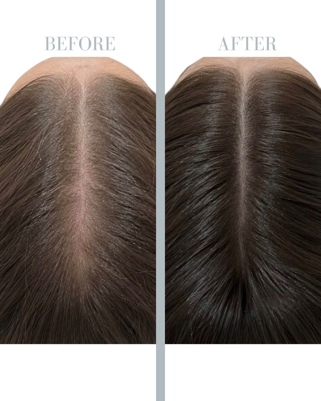Before and after PRP.