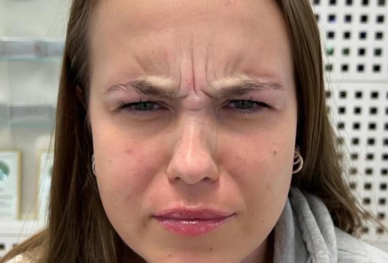 Botox — 5 vanliga myter och vad som faktiskt stämmer
