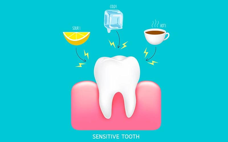 teeth sensitive