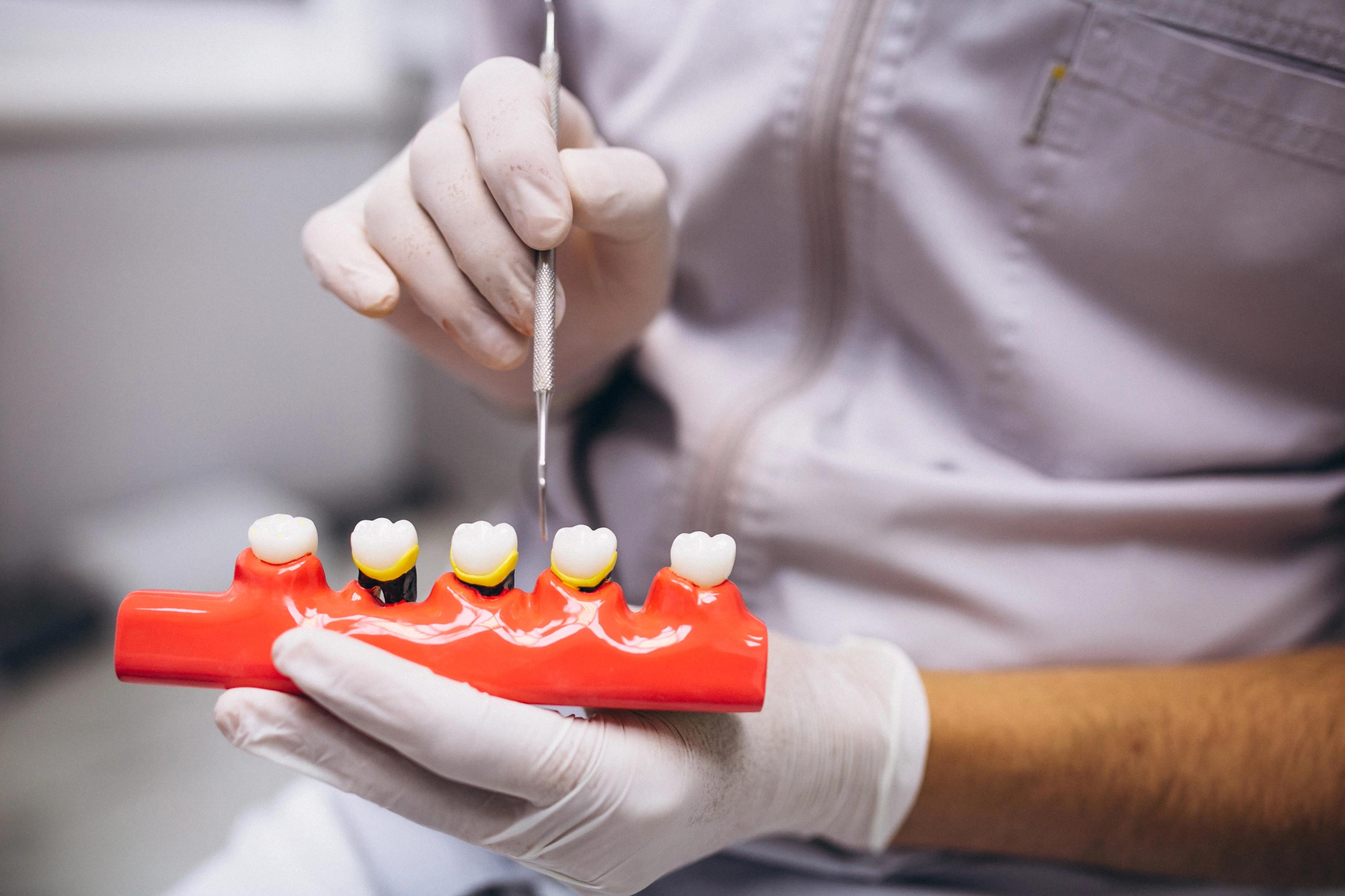 Dentist showing implant material options