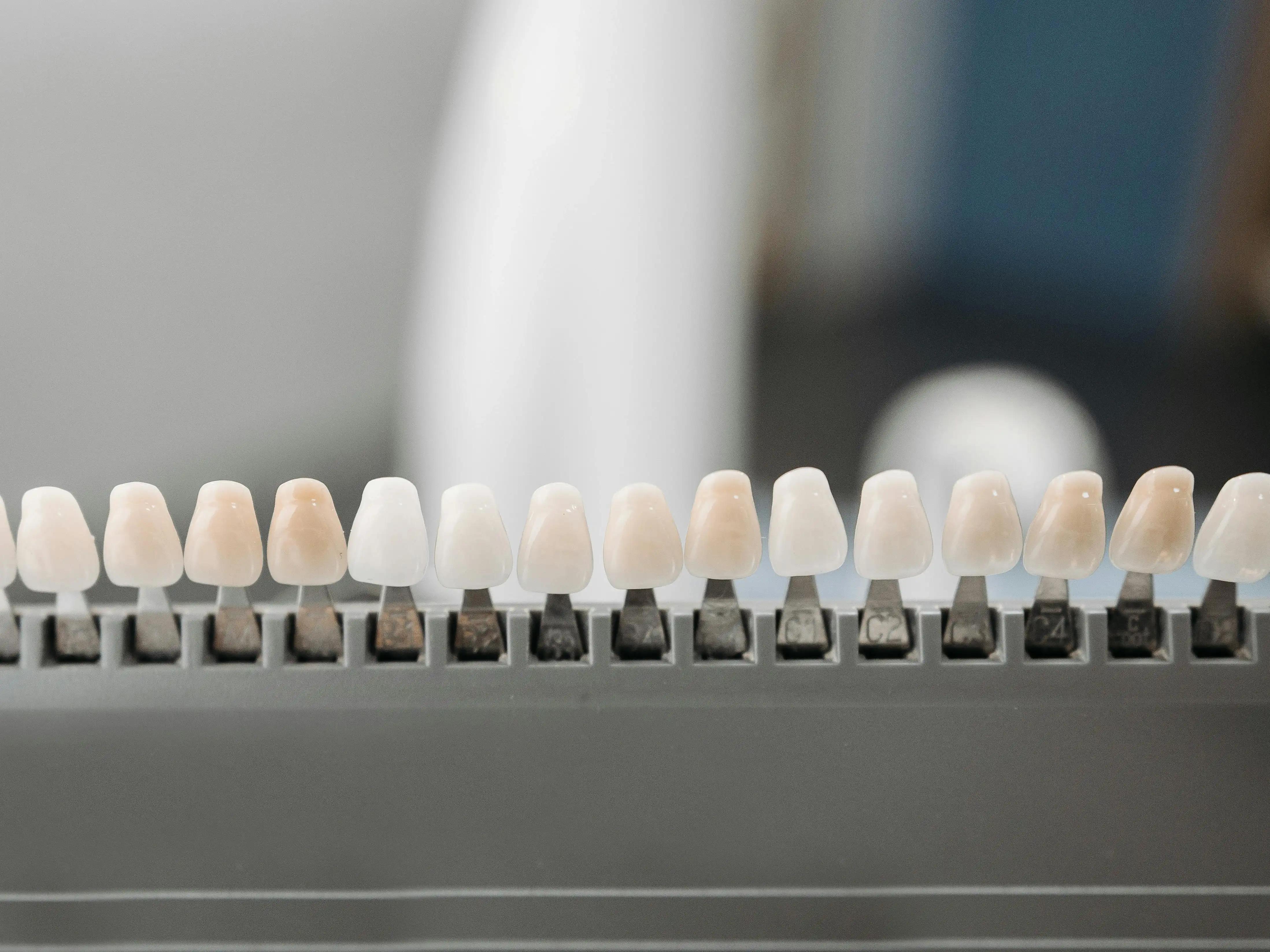 Dental veneers in display 