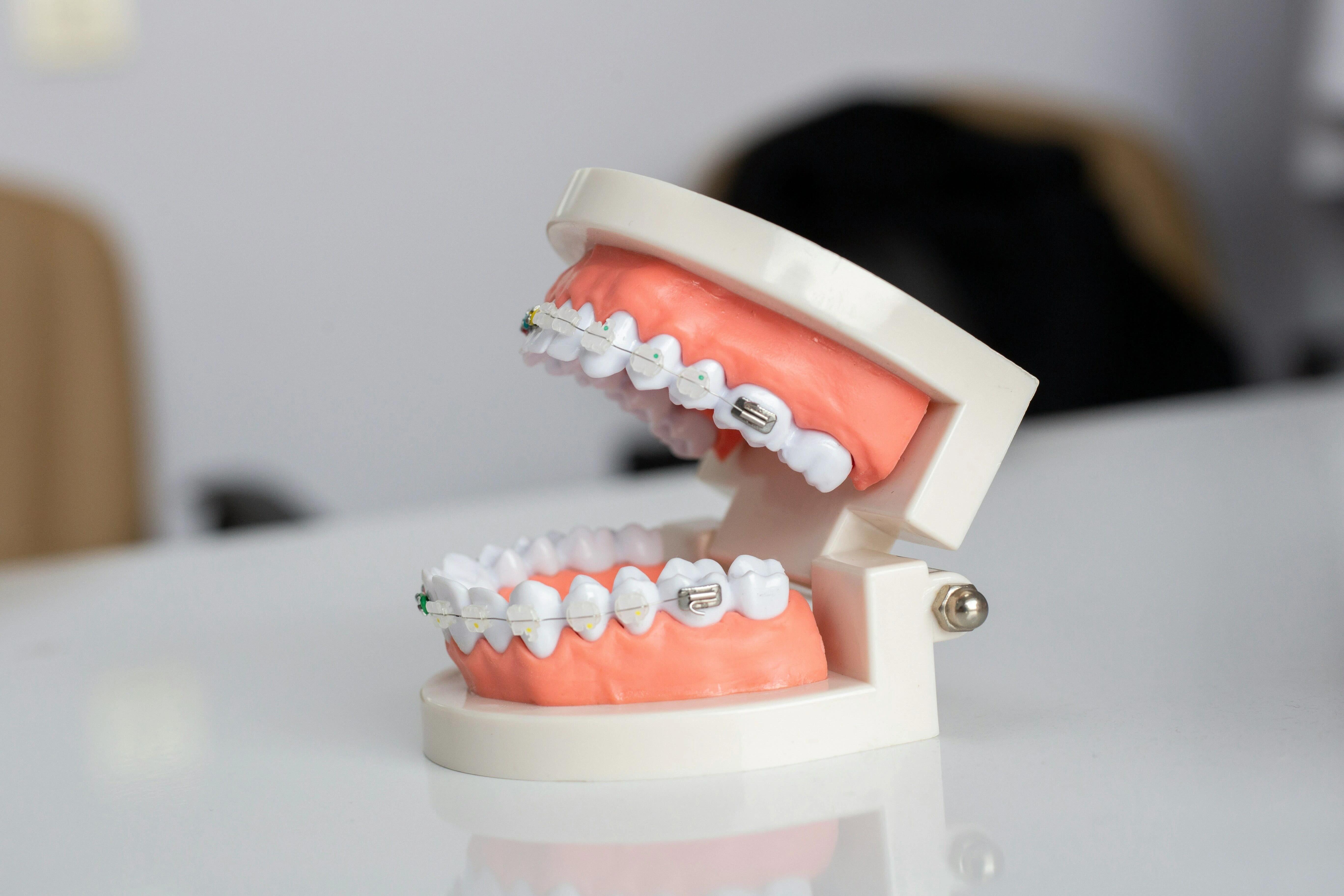 Braces image