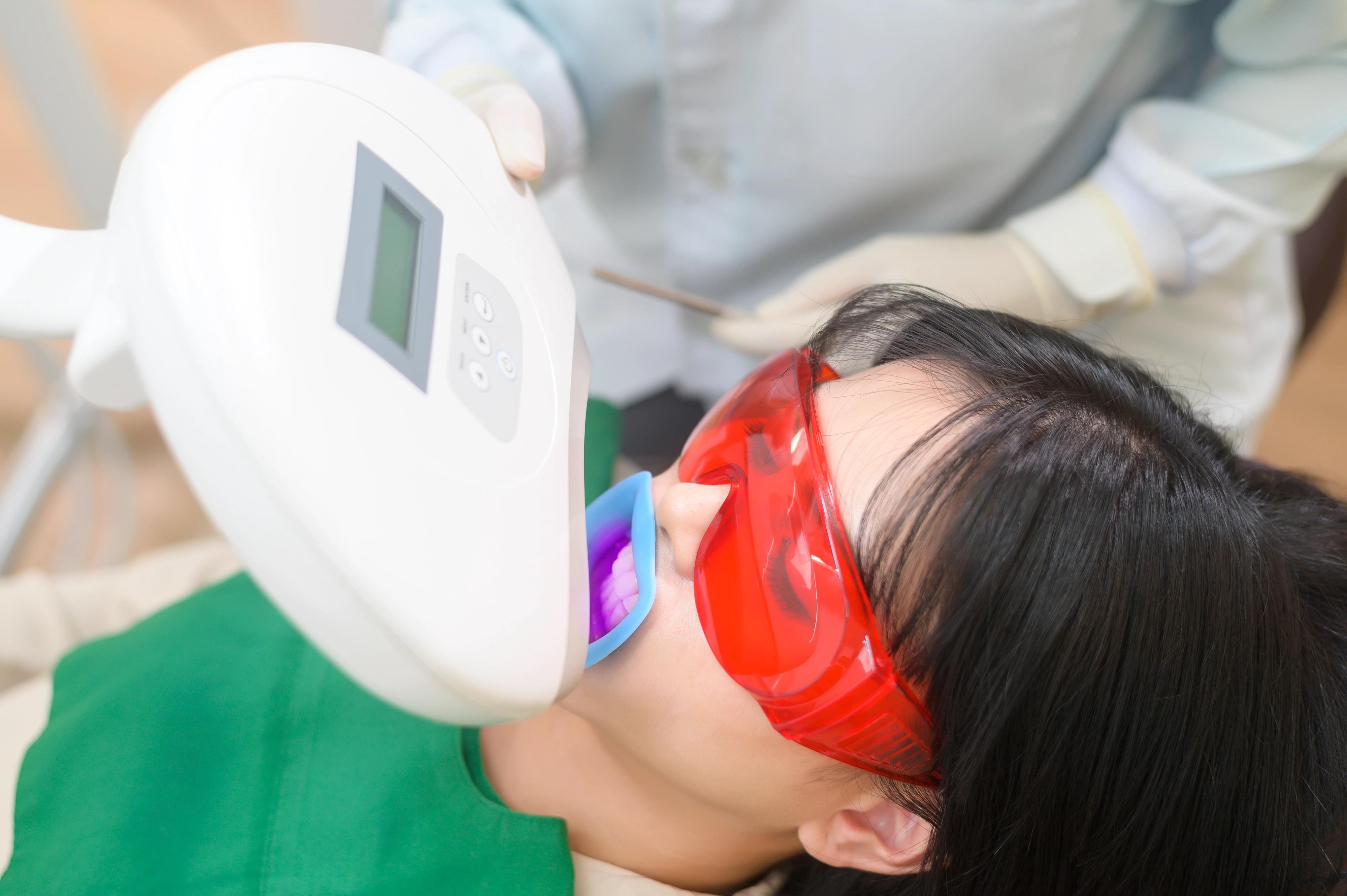 teeth whitening