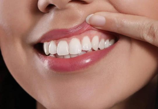 Periodontal Disease Treatment Special Package