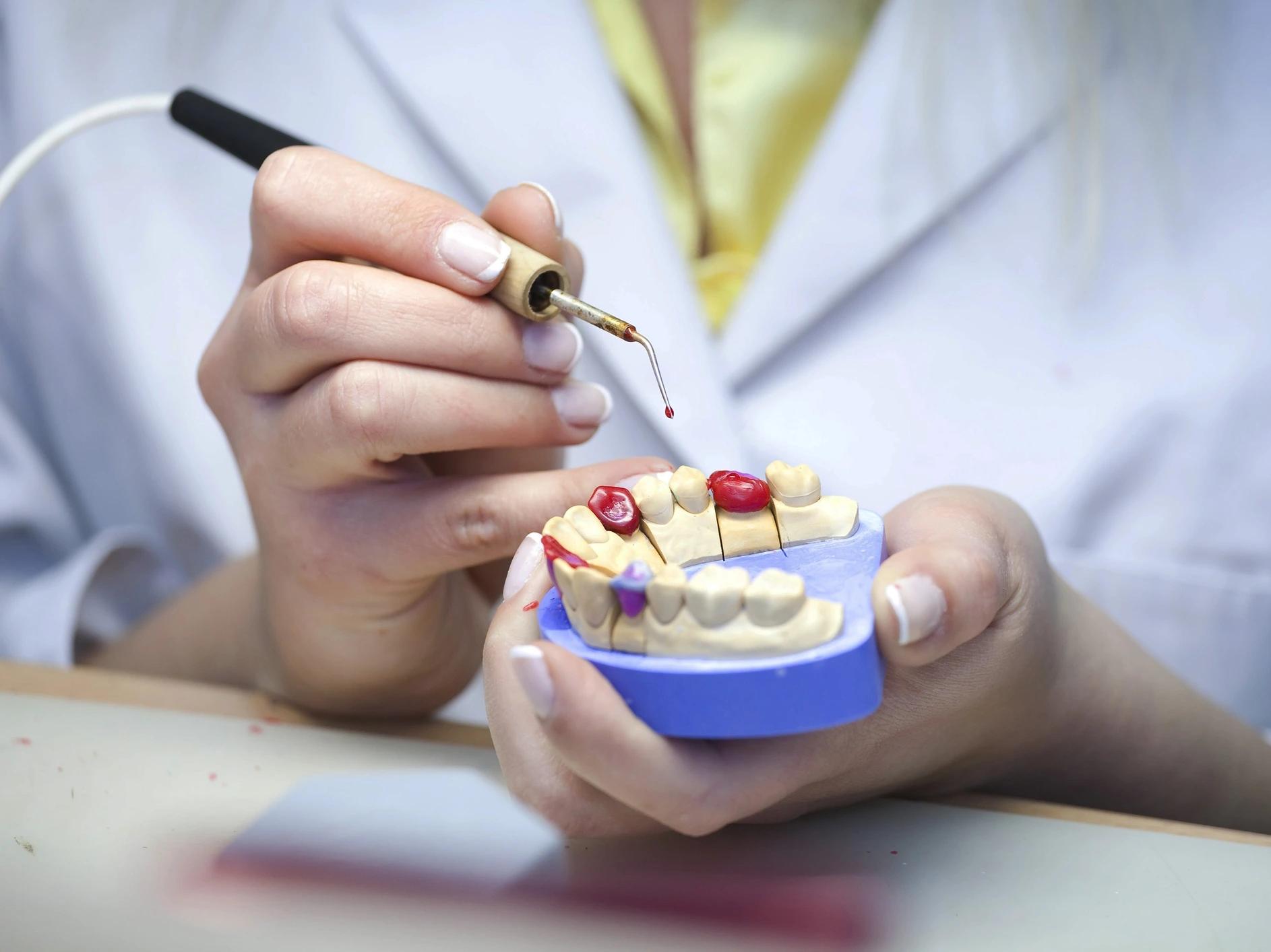 Dentist preparing a dental crown for a dental bridge.
