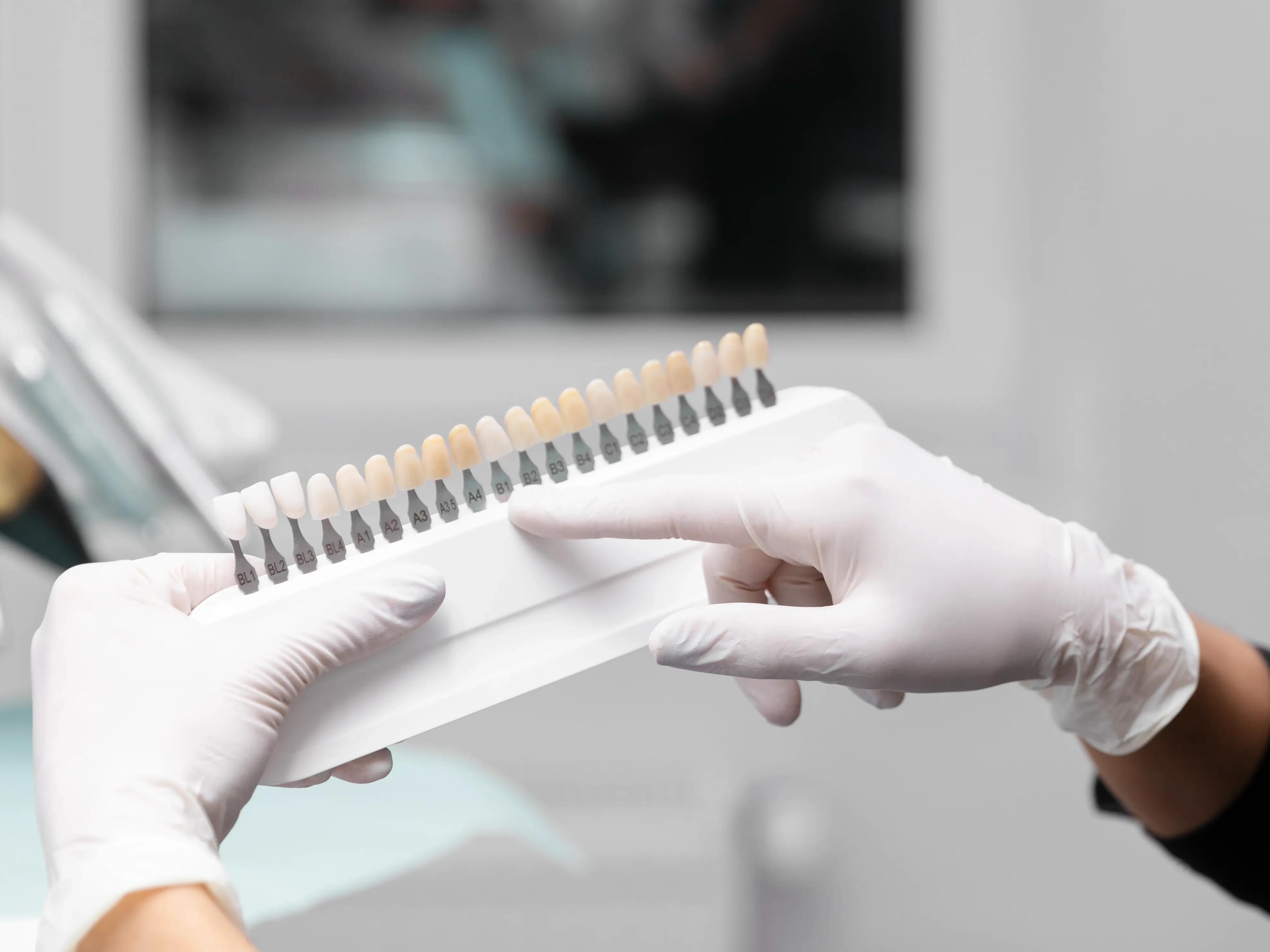 Dentist showing dental veneers