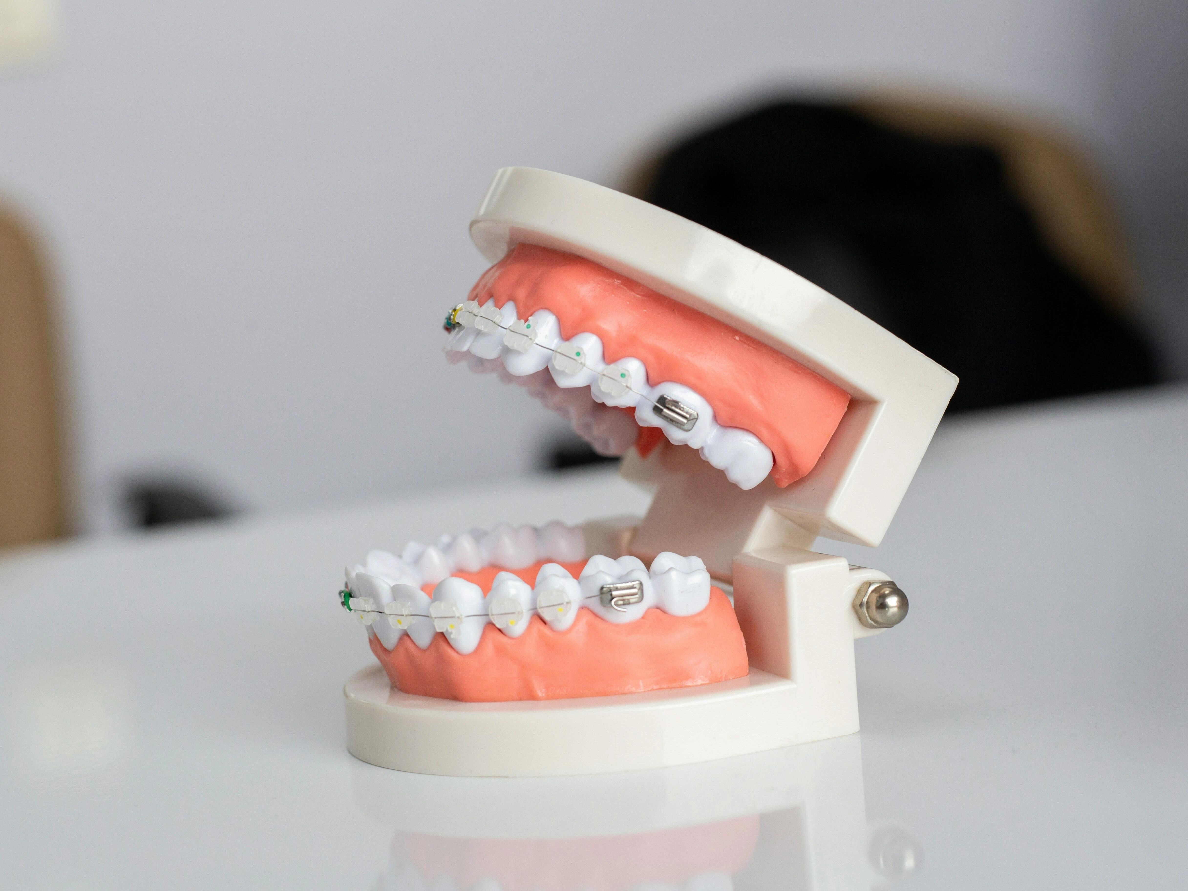 Clear Braces illustration