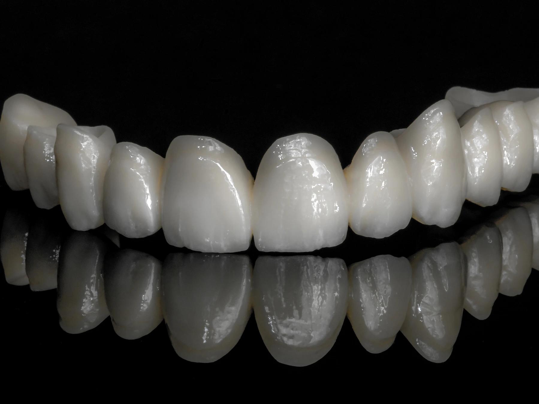 Composite Bonding Teeth