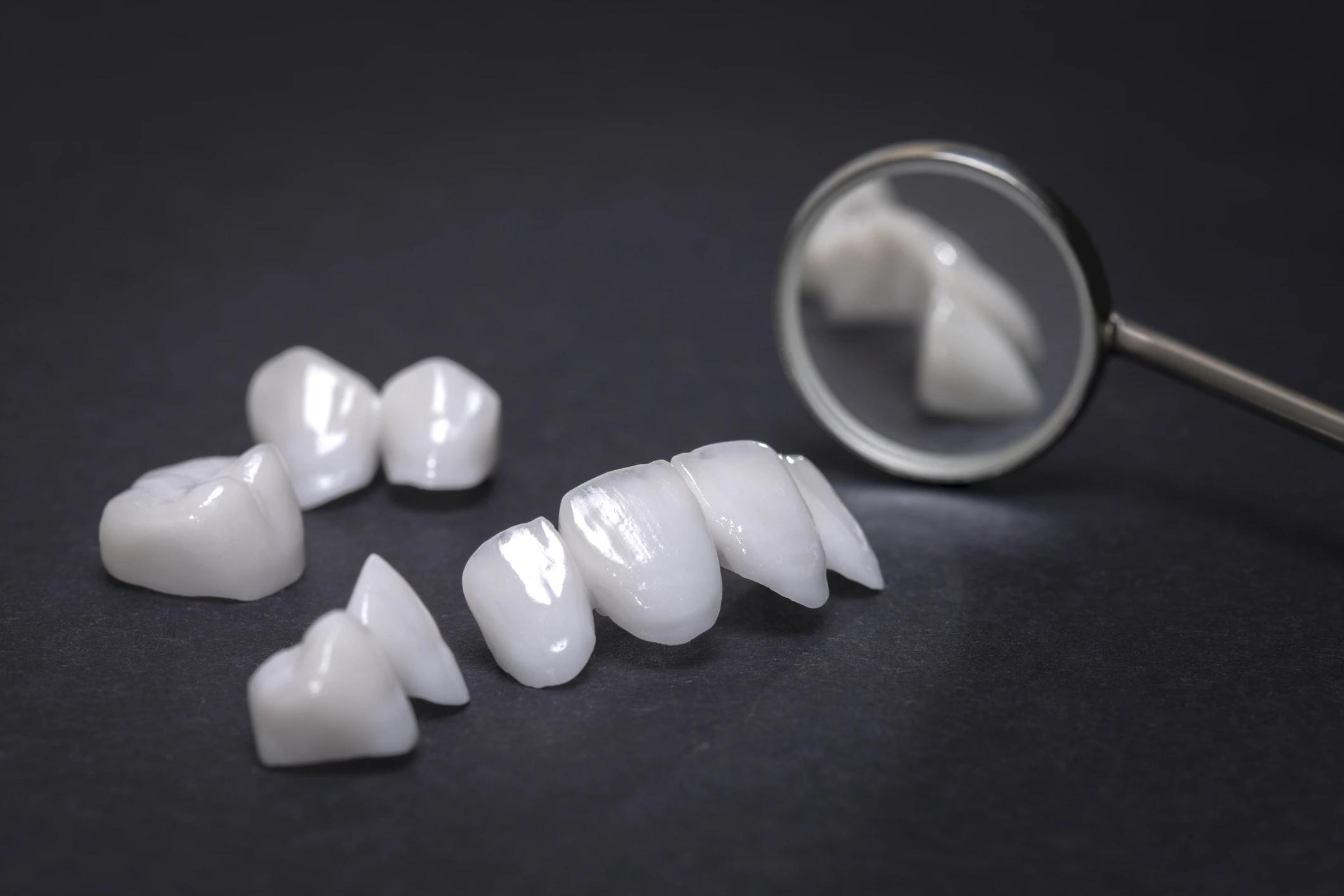 Emax and zirconia dental veneers displayed with dental mirror on dark background