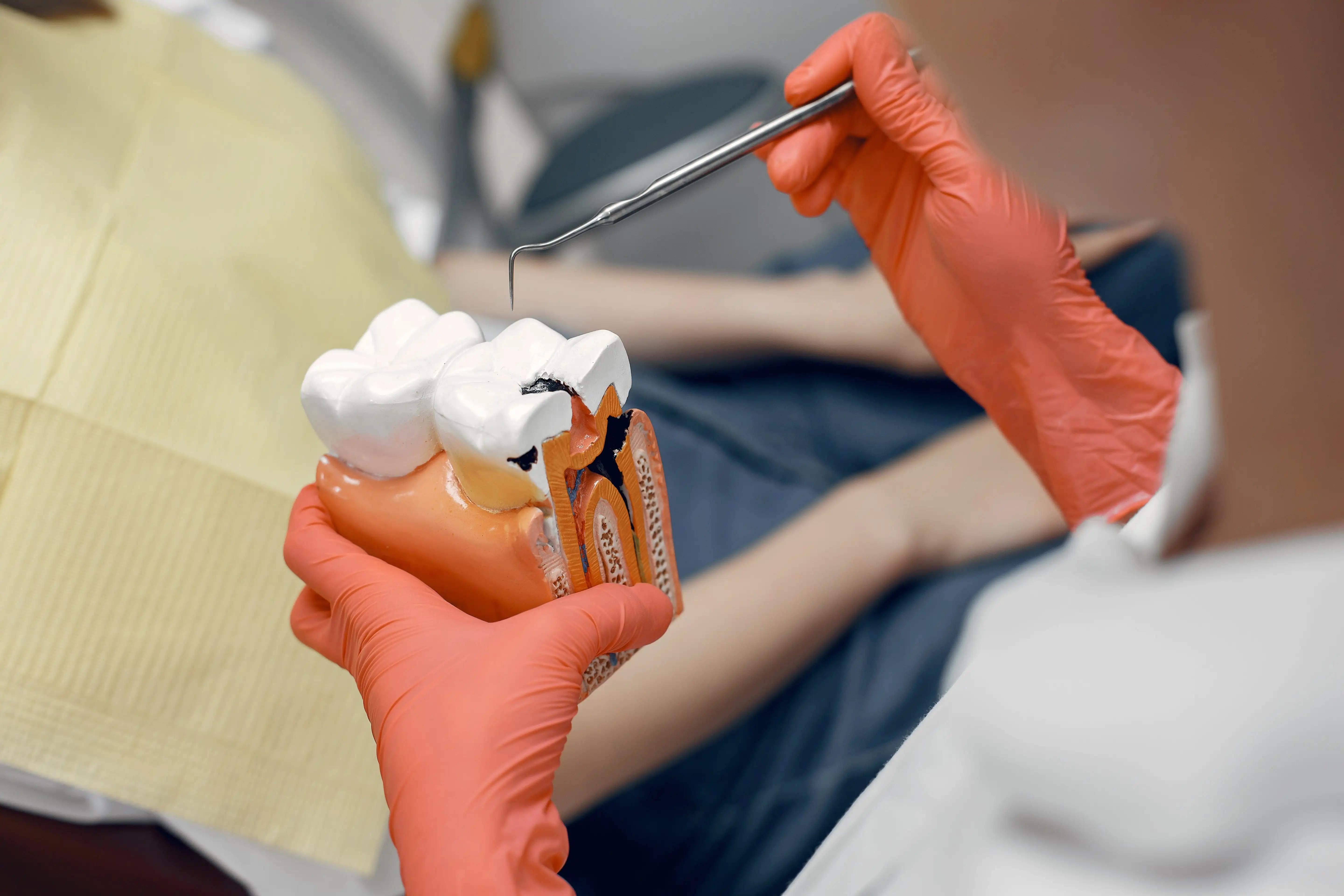 Dental treatment for cavities caused by sugar consumption