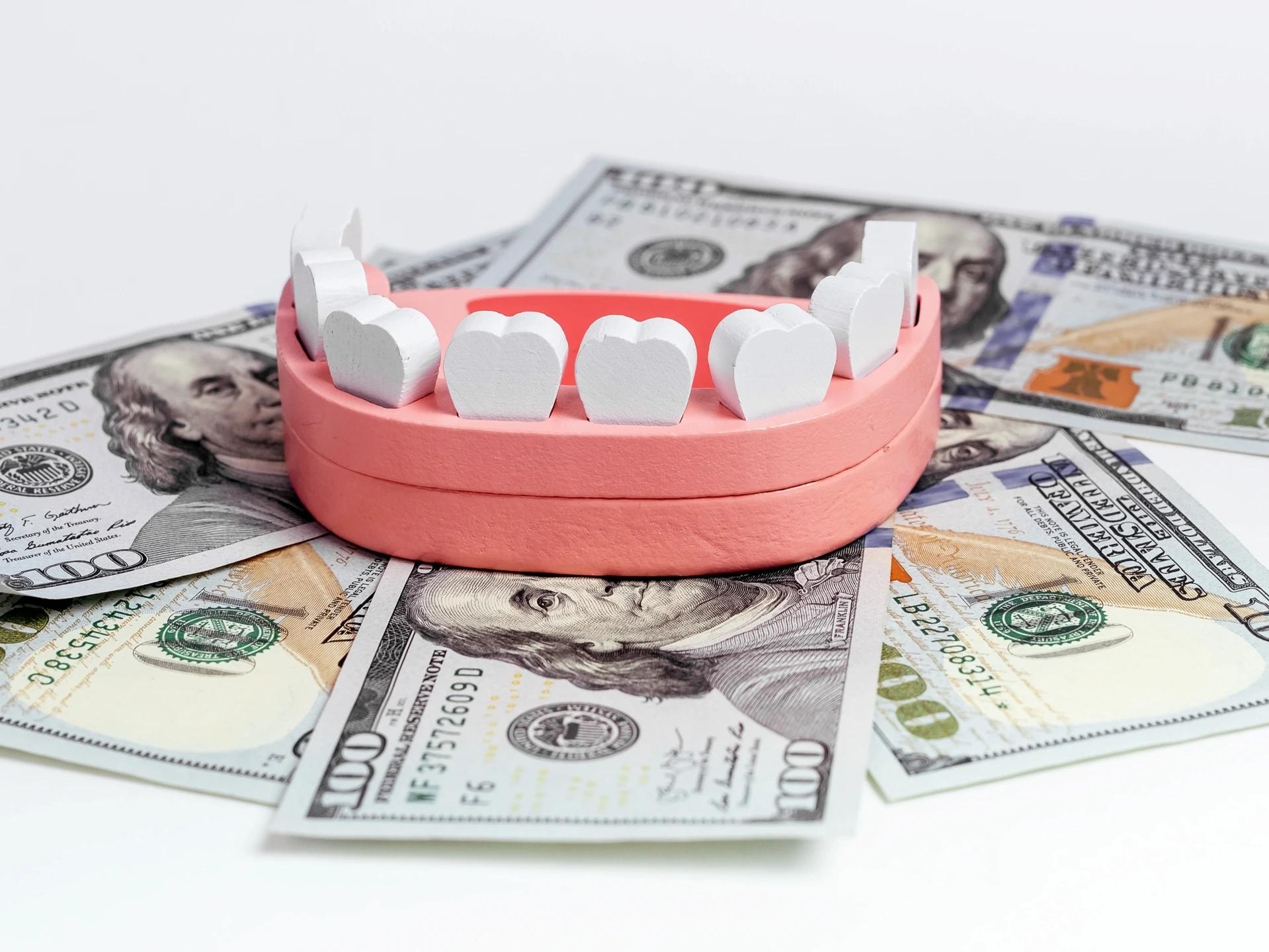 A set of artificial teeth placed on top of money.