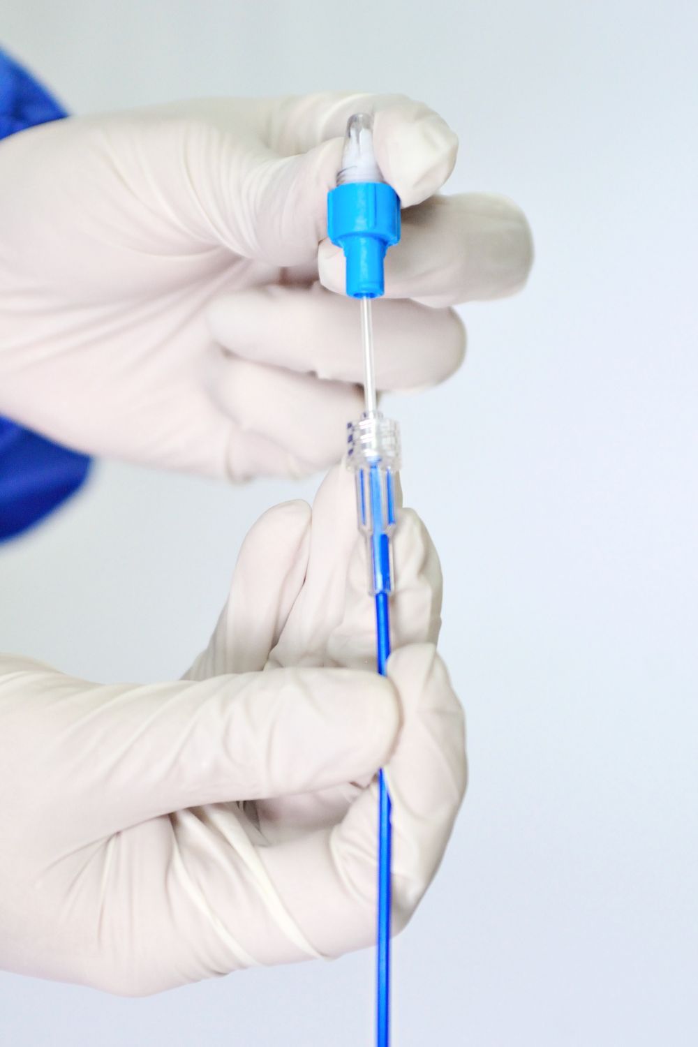 How Prostate Balloon Dilation Works: A Step-by-Step Guide