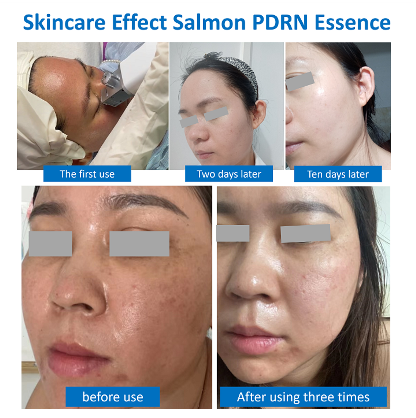 Salmon PDRN Regular Essence