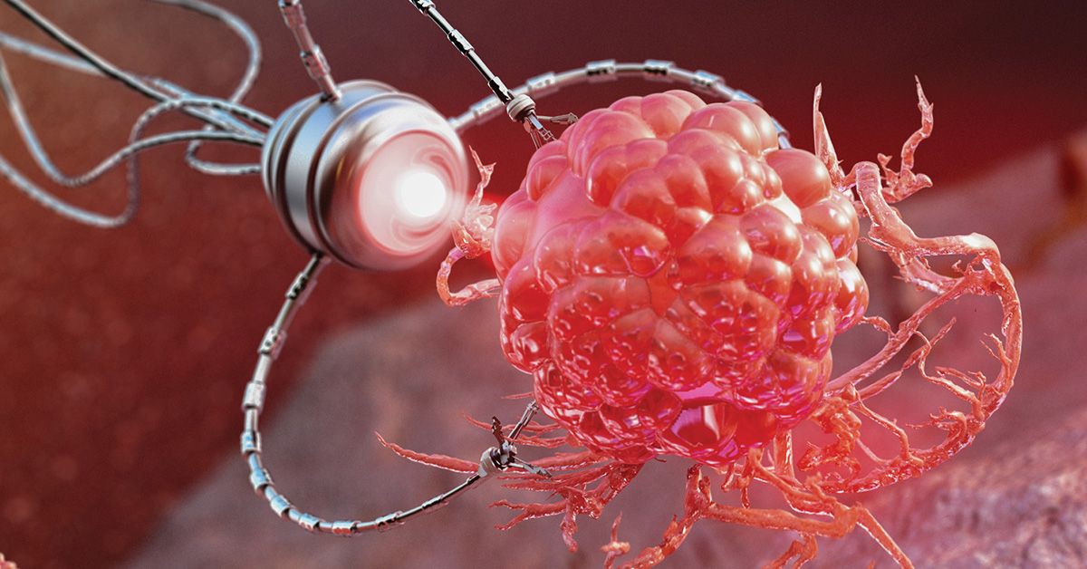A portion of the journal cover for ACS Nano Medicine, depicting a futuristic, glowing red cluster of cells with branching tendrils, connected to a metallic nano-device emitting a light into the cell cluster.   