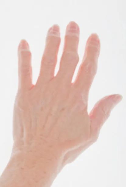 Cover image for “Molecular Hydrogen benefits Rheumatoid Arthritis and MUCH MORE”
