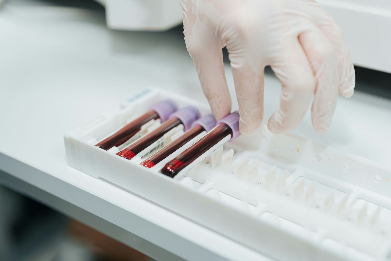 A hand grabbing a vial of blood for Foundations wellness labs and functional testing.