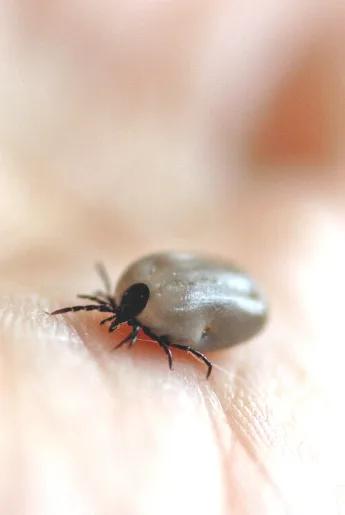 Babesia Tick