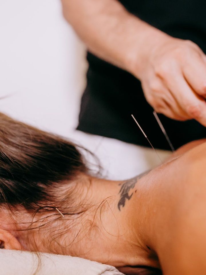 TCM & Acupuncture