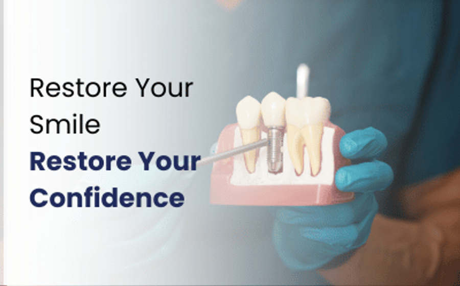 Dentist showing a dental implant model during a consultation for dental implants in Karachi