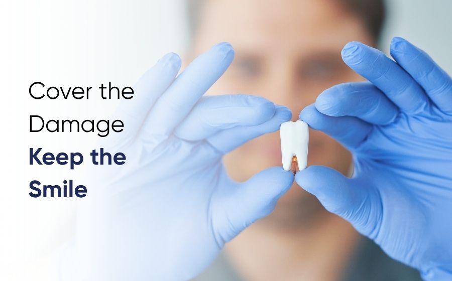 Dentist holding a dental crown for a patient in Rawalpindi at DentoCorrect
