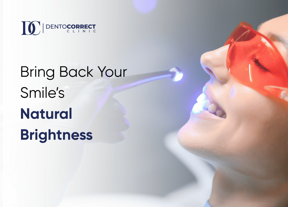 Teeth whitening in Peshawar to bring back your smile's natural brightness