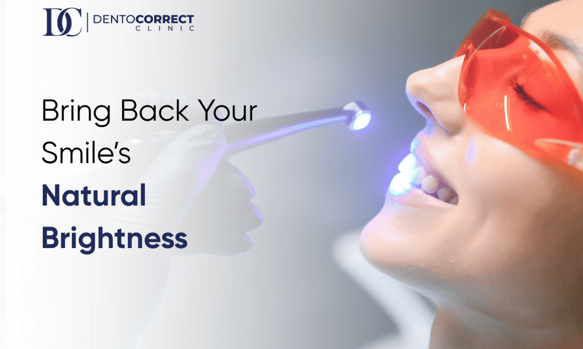 Teeth whitening in Peshawar to bring back your smile's natural brightness