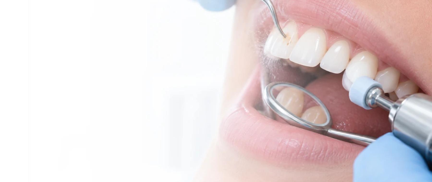 Dentist performing teeth scaling and polishing in Peshawar at DentoCorrect Hayatabad