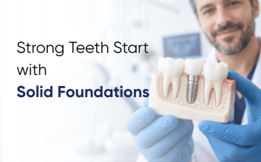 Dental implants in Peshawar: dentist holding a model showing an implant placed in the jawbone