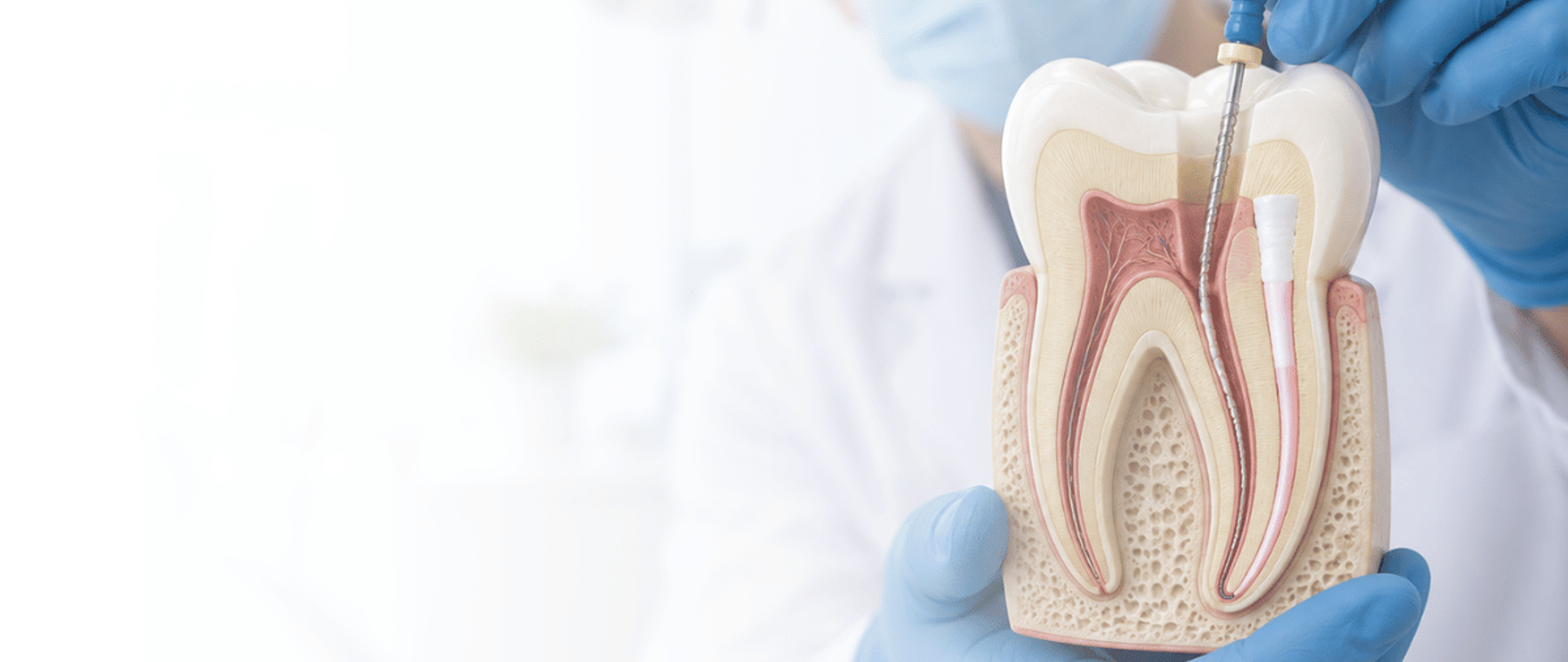 Root canal treatment in Lahore: dentist holding a cross-section model of a tooth showing the root canal