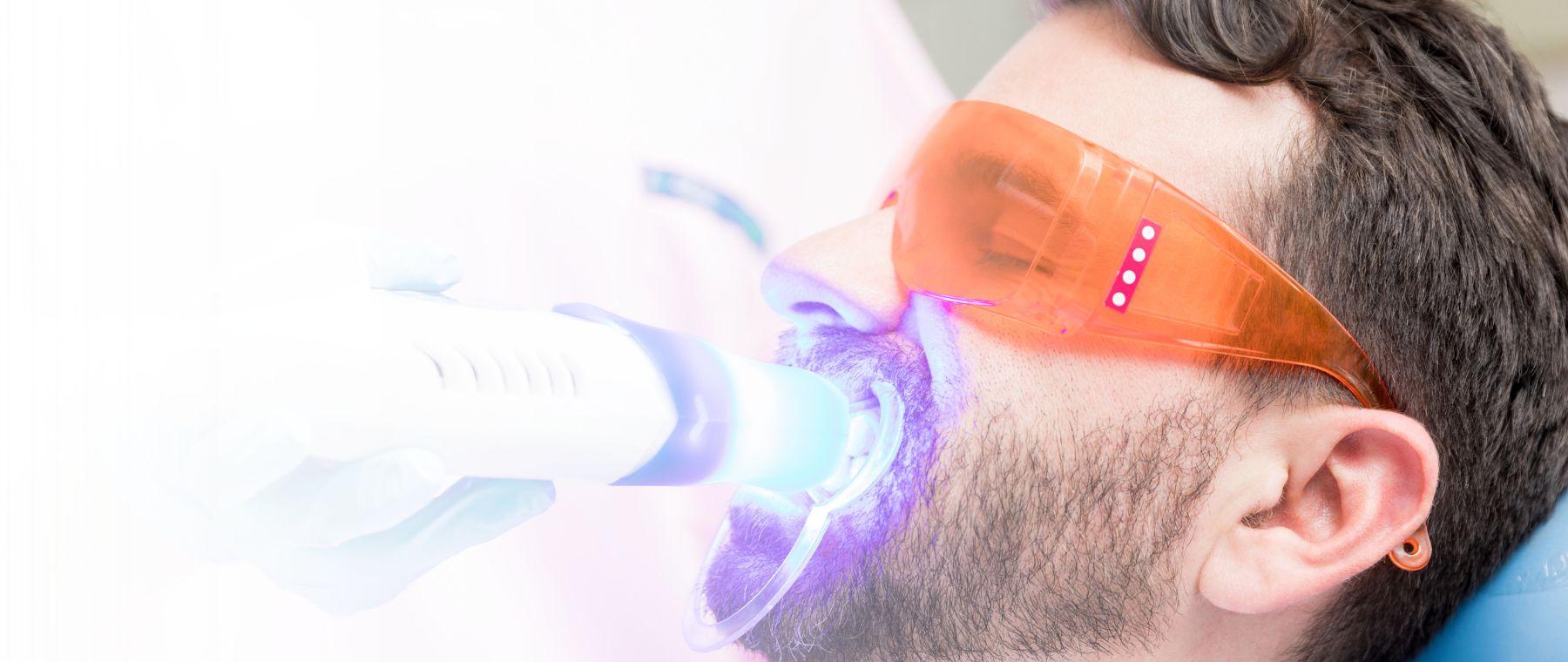 Patient having in-office teeth whitening in Faisalabad